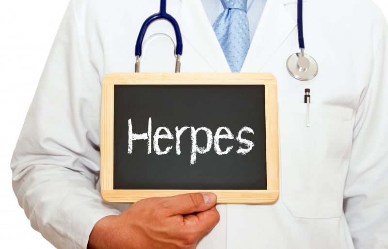 Herpes i underlivet
